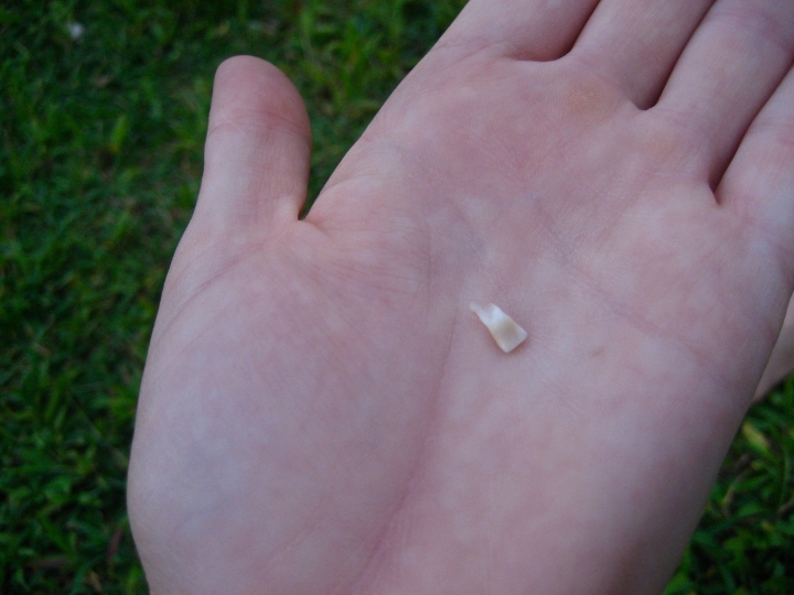 the first lost tooth